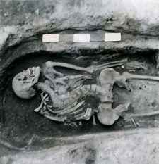 Grave 4-88, human skeleton with birth defects