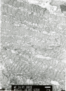 Studies of heart ultrastructure in various diseass by prof A. Fidziańska-Dolot (2004-2013) - 24/05