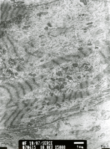 Studies of heart ultrastructure in various diseass by prof A. Fidziańska-Dolot (2004-2013) - 10/07