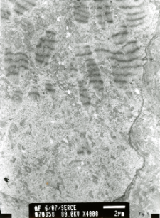 Studies of heart ultrastructure in various diseass by prof A. Fidziańska-Dolot (2004-2013) - 6/07