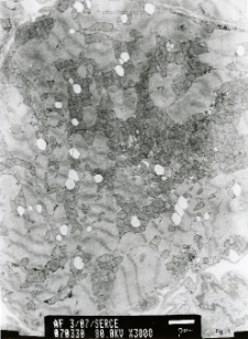 Studies of heart ultrastructure in various diseass by prof A. Fidziańska-Dolot (2004-2013) - 3/07