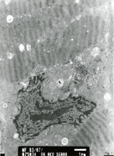 Studies of heart ultrastructure in various diseass by prof A. Fidziańska-Dolot (2004-2013) - 83/07