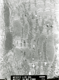 Studies of heart ultrastructure in various diseass by prof A. Fidziańska-Dolot (2004-2013) - 6/05