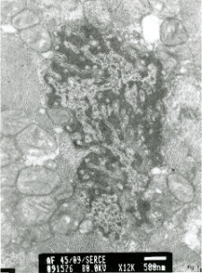 Studies of heart ultrastructure in various diseass by prof A. Fidziańska-Dolot (2004-2013) - 45/09