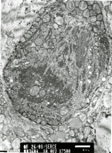 Studies of heart ultrastructure in various diseass by prof A. Fidziańska-Dolot (2004-2013) - 26/08