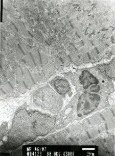 Studies of heart ultrastructure in various diseass by prof A. Fidziańska-Dolot (2004-2013) - 46/07