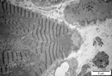 Studies of heart ultrastructure in various diseass by dr Michal Walski - 47/1